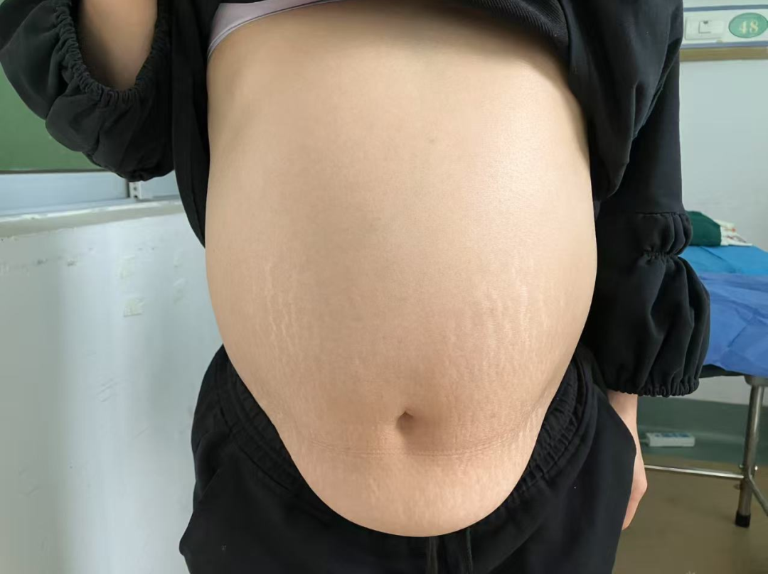 ͼƬ